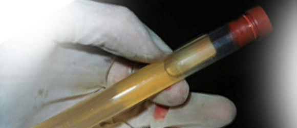 NDV-Induced Serum
